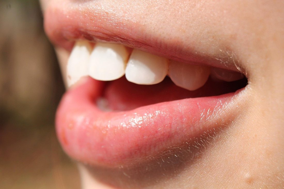 Smile after treatment — illustrative example