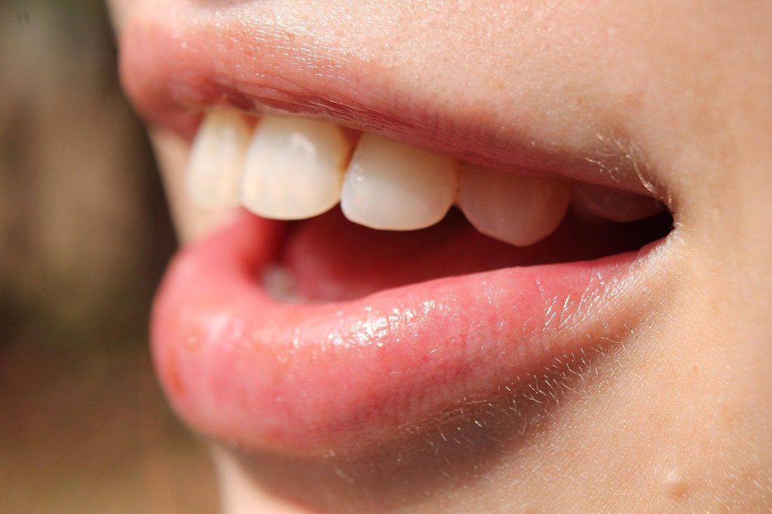 Smile before treatment — illustrative example