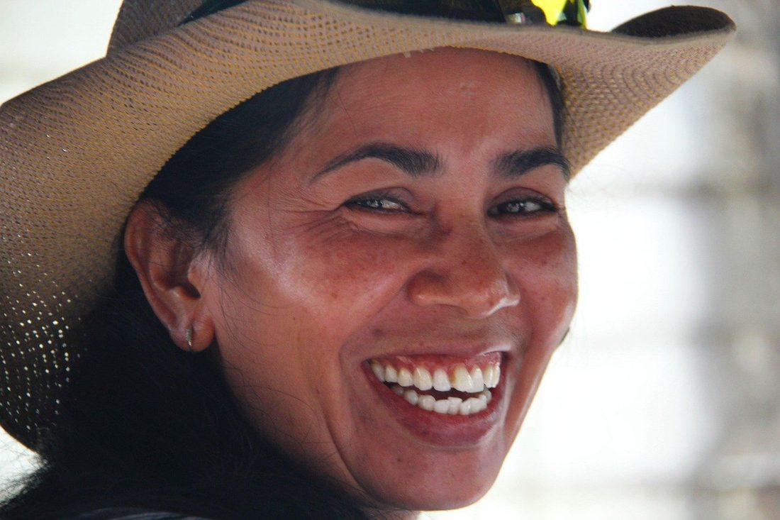 Smile after treatment — illustrative example